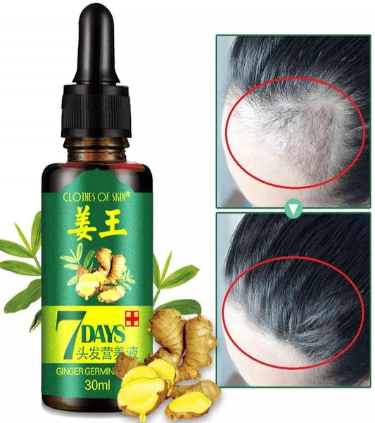 7 Days Spray Hair Growth Germinal Serum Oil – Natural Hair Treatment (30ML)