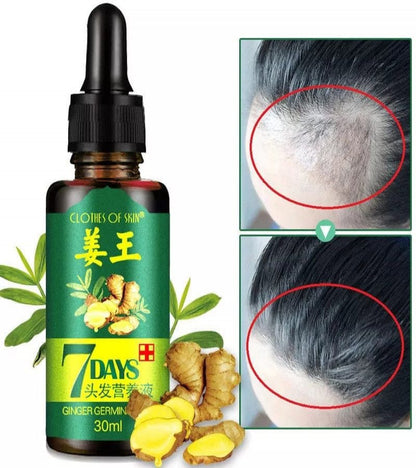 7 Days Spray Hair Growth Germinal Serum Oil – Natural Hair Treatment (30ML)