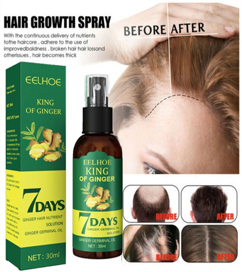 7 Days Spray Hair Growth Germinal Serum Oil – Natural Hair Treatment (30ML)
