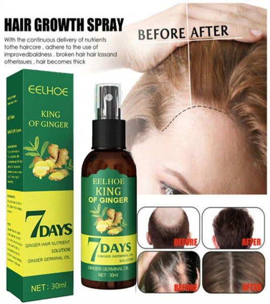 7 Days Spray Hair Growth Germinal Serum Oil – Natural Hair Treatment (30ML)